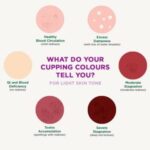 Acupuncture cupping color mark meanings