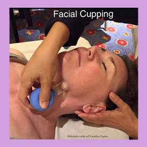 facial cupping